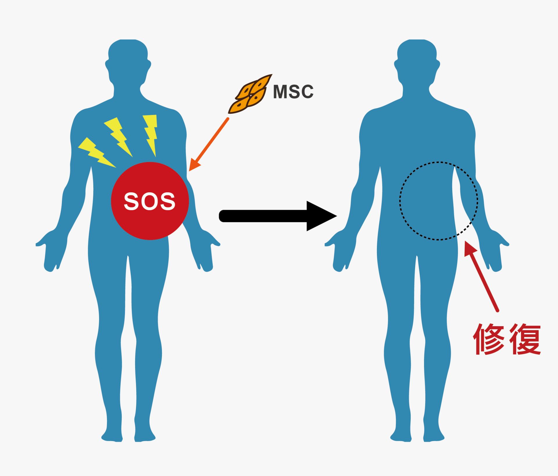 圖一、間質幹細胞歸航作用 (Stem cell homing effect)
